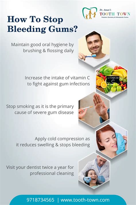 What are the Bleeding Gums Causes and its Treatment