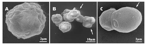 Ultrastructural Study of Acanthamoeba polyphaga Trophozoites and Cysts ...