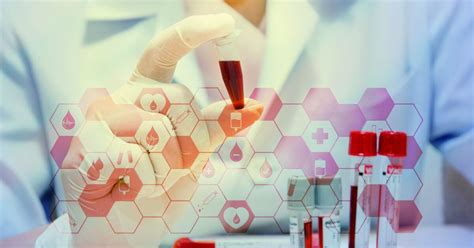 Red Biotechnology 的图像结果