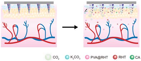 State of the Art in Constructing Gas-Propelled Dissolving Microneedles ...