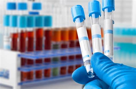 Image result for Un Label Lab