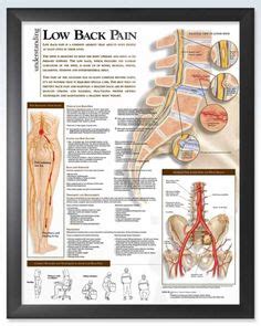 Image result for Lower Back Pain Chart