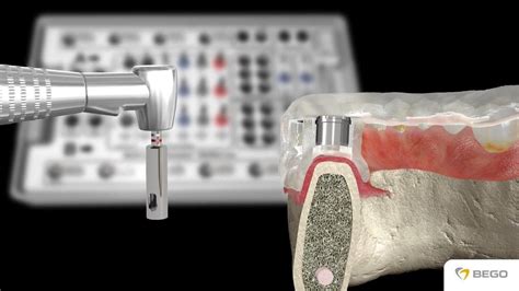 Image result for Bego Tutorials