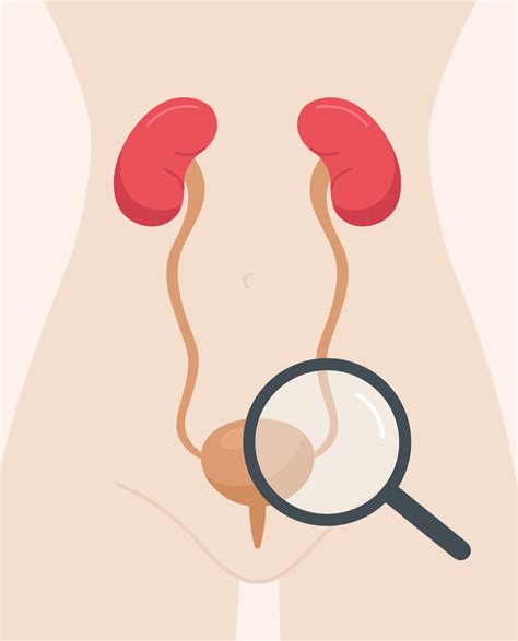 Urinary tract infections (UTI) in women - SynappseHealth