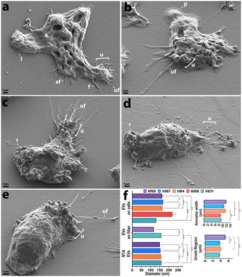 Naegleria Fowleri Slide