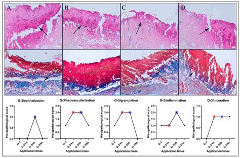 Effect of 10 kV/m Electric Field Therapy in a Pressure Injury Model in ...
