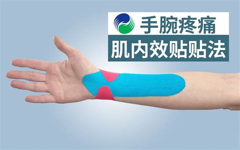 手腕疼痛的肌内效贴贴法【肌贴】_哔哩哔哩_bilibili