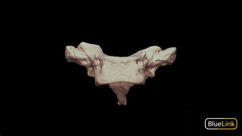 Thoracic Vertebrae - T1, Labeled - 3D model by Bluelink Anatomy ...