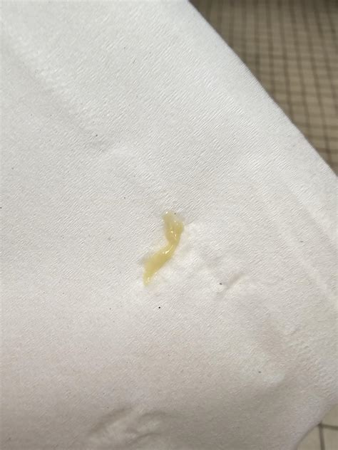 Bright Yellowish Discharge First Pregnancy