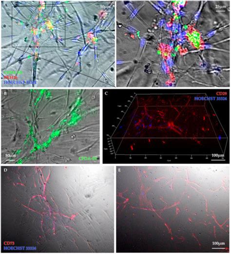 Angiogenic Potential of Bone Marrow Derived CD133+ and CD271 ...