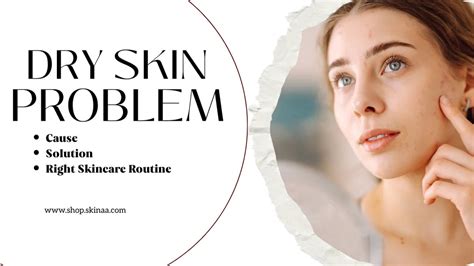 Dry Skin Problems: Causes, Solutions & The Right Skincare Routine – Skinaa