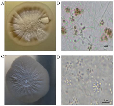 JoF | Special Issue : New Perspectives on Sporothrix and Sporotrichosis
