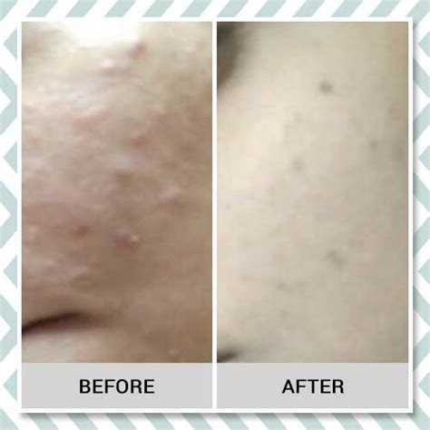 Loved by us, loved by them, loved by all! – The Natural Wash