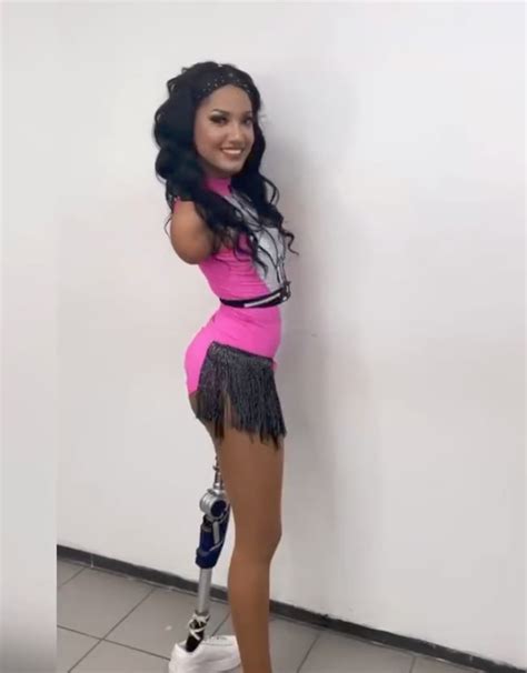 I'm a triple amputee and a hot model — nothing holds me back