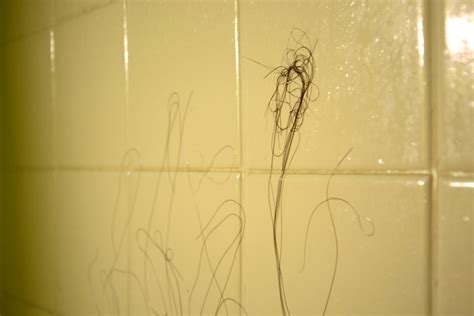 Hair Loss Doesn’t Start When Hair Falls – Svarasa