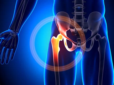 Symptoms, Diagnosis, and Treatment of Femoral Acetabular Impingement