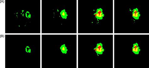 Post-Processing Fortnite 的图像结果