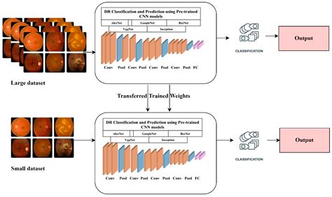 A Systematic Literature Review on Diabetic Retinopathy Using an ...