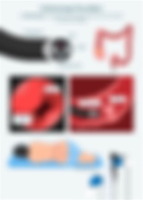 Colonoscopy Process 的图像结果