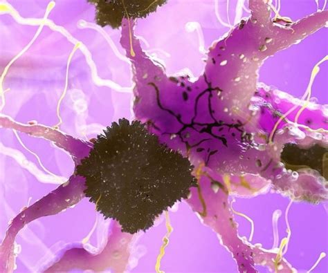 Finger-Stick Blood Test Detects Alzheimer's Markers | Newsmax.com