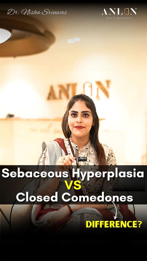 ANLON ART SALON | ⚡️C L A S S I C F A D E⚡️ . . . Head over to @anlon.artsalon for a ...