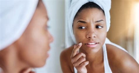 Scientists Just Discovered a Pimple Patch That May Work Better Than Most Acne Creams