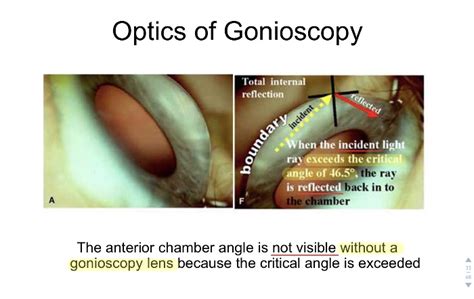 Angle Recession 的图像结果
