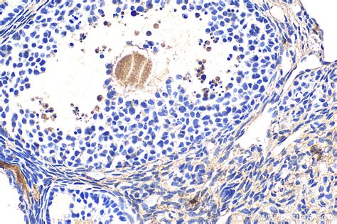 S100A9 antibody (33247-1-AP) | Proteintech