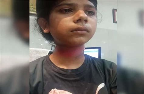 Chinese डोर की चपेट में आया 13 वर्षीय मासूम, गम्भीर घायल - 13 year old ...
