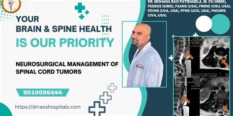 Spinal Cord Tumors – Neurosurgical Management at Dr. Rao’s