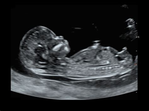 CD50 Pro AI - Konica Minolta