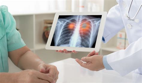 Parliament panel recommends hub-and-spoke model for cancer treatment ...
