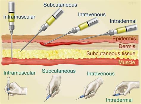 Image result for Subcut Injection OSCE