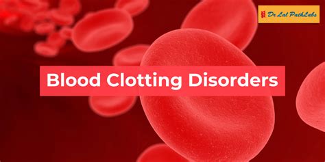 Clotting Disorders 的图像结果