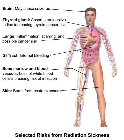 Radiation Exposure: What are the Dangers?