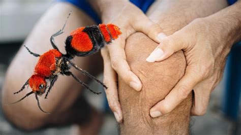 'Cow Killer' Ant Leaves Florida Man With Nasty Bite, 'Excruciating ...