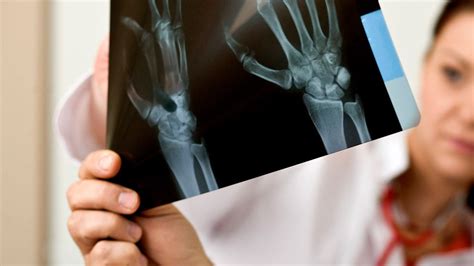8 Surprising Signs Your Rheumatoid Arthritis Is Progressing | Reactive ...