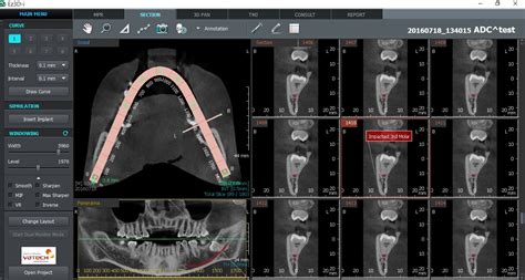 Buy Vatech PaX-i 3D CB CITY Online at Best Prices - ID Enterprises