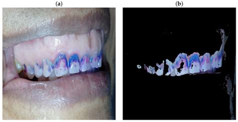 Deep Learning in Oral Hygiene: Automated Dental Plaque Detection via ...