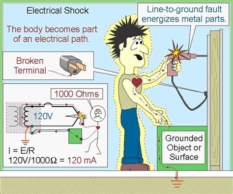 Electricity Shock 的图像结果
