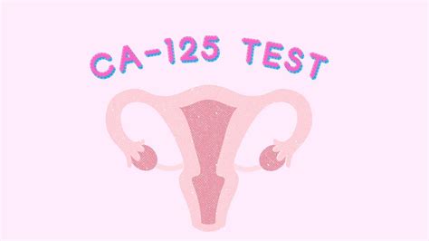 CA-125 Test: All You Need To Know