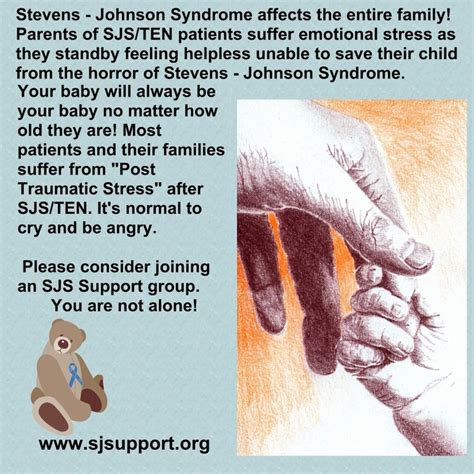 Rash Pictures SJS 的图像结果