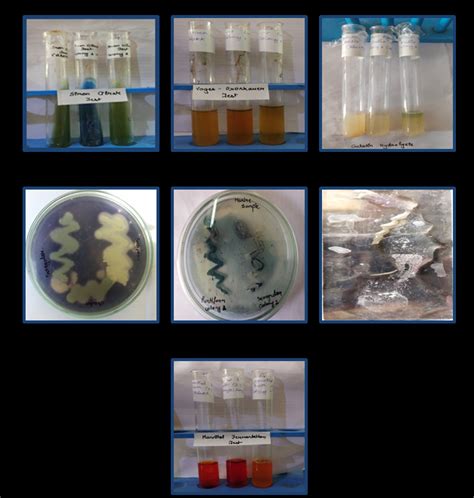Fig. 2: Observations of biochemical tests