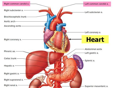 Carotid artery disease - Stenosis, Carotid Artery Dissection
