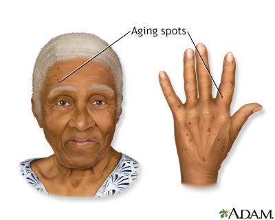 Aging Sign 的图像结果