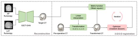 Robust Orthogonal-View 2-D/3-D Rigid Registration for Minimally ...