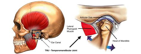 Temporomandibular Joint Dysfunction Lawyer in Edmonton & Red Deer | TMJ ...