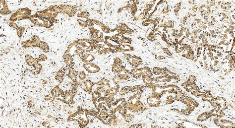 JNK antibody (51153-1-AP) | Proteintech