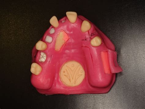 Partial Thickness Flap Implant Model | V-Invent
