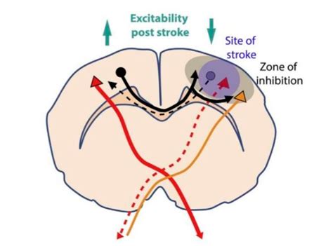 Promotion of Poststroke Motor-Function Recovery with Repetitive ...